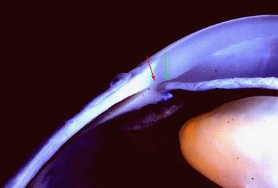 IL GLAUCOMA NEL CANE E NEL GATTO