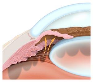 IL GLAUCOMA NEL CANE E NEL GATTO