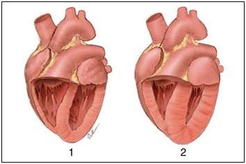 CARDIOMIOPATIA IPERTROFICA DEL GATTO