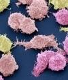 Nuovi database per il profilo genetico dei tumori