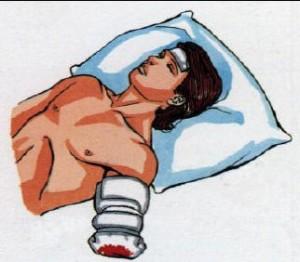 biid Biid: la voglia di liberarsi di un arto sano