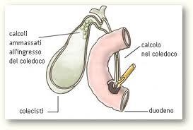 Problemi di colecisti? Una dieta aiuta, prima e dopo