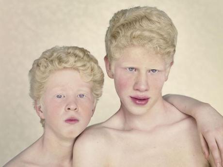 Albinos: gli angeli caduti di Gustavo Lacerda