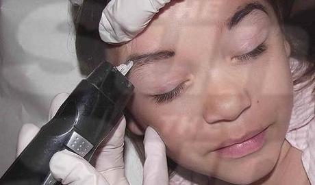 Iniezioni di botox a sette anni “Mia figlia sarà una star”