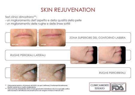 FaceFX 1 IMETEC Bellissima FaceFX + piccolo premio