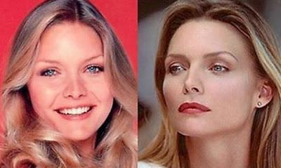 Le star prima e dopo il chirurgo: Michelle Pfeiffer