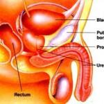 Prostatite: cause trattamento e cure