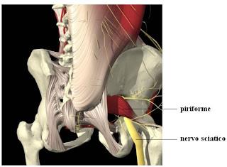 La sindrome del piriforme