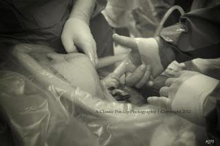 Neonata stringe la mano del ginecologo che la fa nascere Neonata stringe la mano del ginecologo che la fa nascere