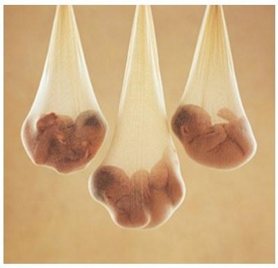 IVF: 1,7 milioni di embrioni buttati via embrioni