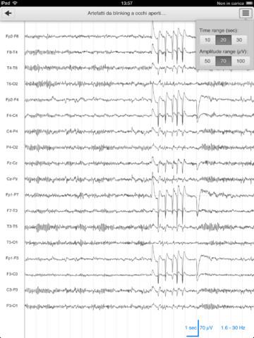 EEG Guide: ebook teorico e pratico sull’elettroencefalografia