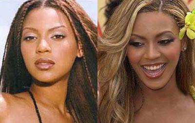 Le star prima e dopo il chirurgo: Beyoncé