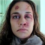 “Anno peggiore della mia vita”: spot choc contro violenza domestica