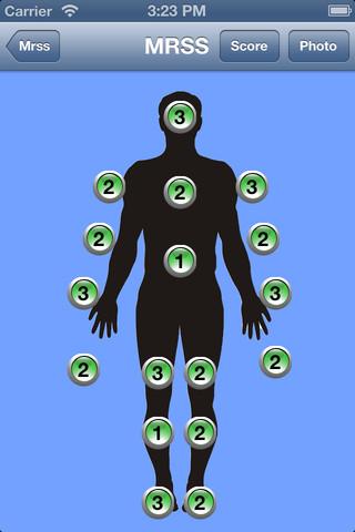 Reumatologia: ecco l’app per il calcolo del Rodnan Skin Score modificato