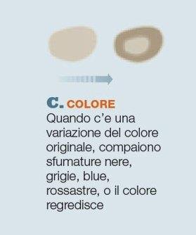 controllo nei - colore