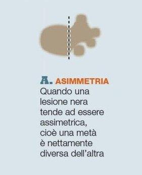 controllo nei - asimmetria