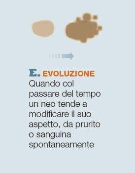 controllo nei - evoluzione