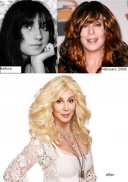 Le star prima e dopo il chirurgo: Cher