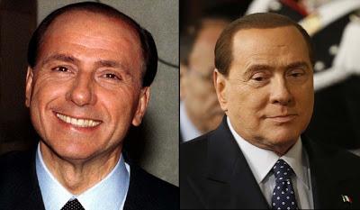 Le star prima e dopo il chirurgo: Silvio Berlusconi