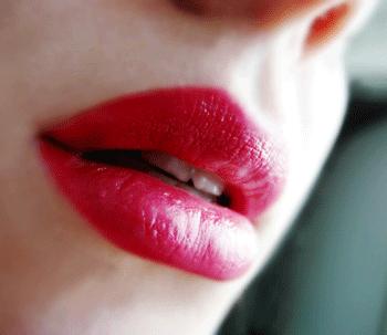 Filler labbra, un aiuto per migliorare forma e turgore