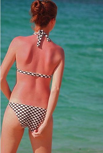 Abbronzatura: Scottature ed Eritemi Solari Rimedi Abbronzatura Scottature ed Eritemi Solari Rimedi 3 Abbronzatura: Scottature ed Eritemi Solari Rimedi