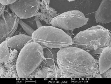 Bari/ San Giorgio. Rilevata alga tossica in mare. Divieto di balneazione. Ostreopsis ovata