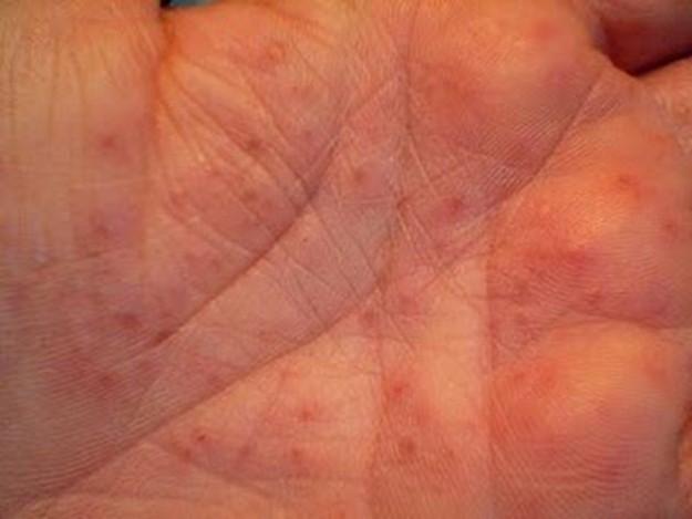 Cosmetici a dermatite atopic a bambini