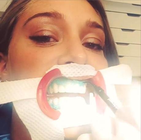 Belen Rodriguez dal dentista: sbiancamento prematrimoniale #paura