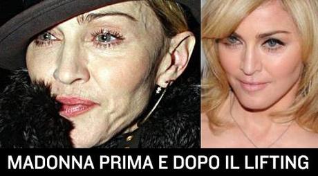 Madonna prima e dopo il lifting a 52 anni rifatta.
