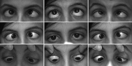 NF212 – Convergenza Oculare. Parte 1