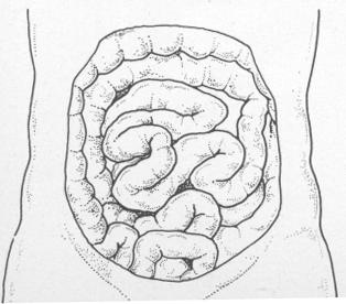 cervello nella pancia