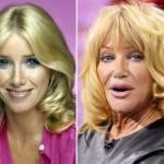 Suzanne Somers