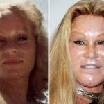 Jocelyn Wildenstein