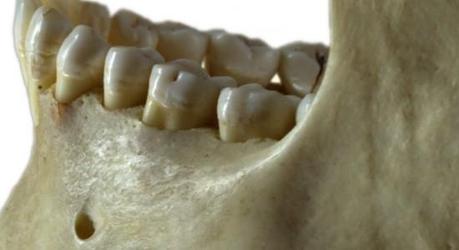 Indagine su antichi denti e antichi microbi