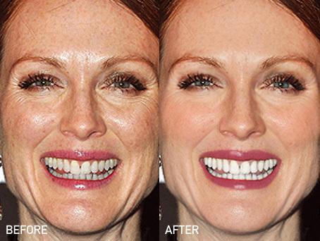 julianne-moore-before-after