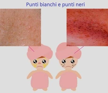 Rimuovere i punti neri e bianchi definitivamente