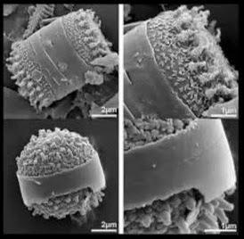 I benefici per la salute della terra diatomacea (articolo del dottor  Dee McCaffrey)  - ... depura l'intestino, elimina l'alluminio, ringiovanisce la pelle, rinforza i vasi sanguigni, e le ossa, combatte l'osteoporosi e ...