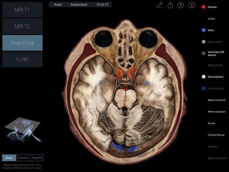 Head Radiology App recensione 3D4Medical Mobimed_4