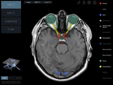 Head Radiology App recensione 3D4Medical Mobimed_3