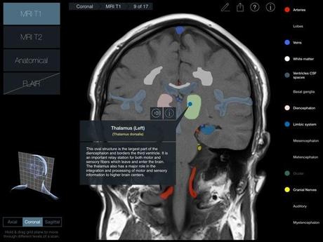 Head Radiology App recensione 3D4Medical Mobimed_2