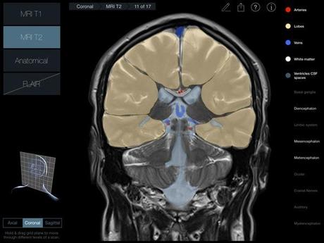 Head Radiology App recensione 3D4Medical Mobimed_6