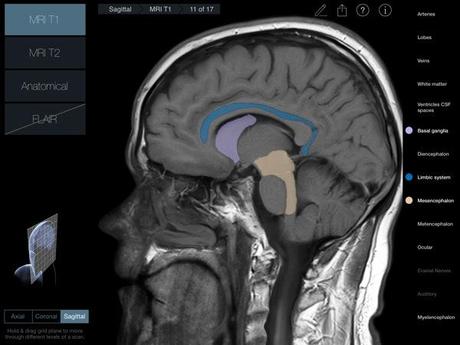 Head Radiology App recensione 3D4Medical Mobimed_1