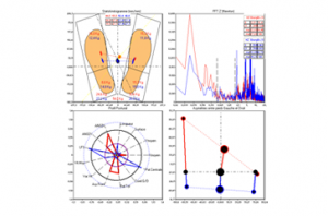 stabilometria_4