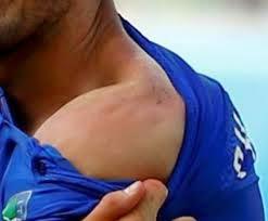 Luis Suarez e il morso da cannibali ai Mondiali