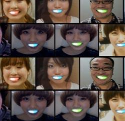 sorriso_led_luminosi Sorriso luminoso