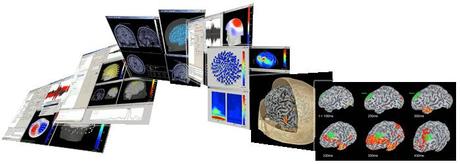 Brainstorm per visualizzare “tempeste cerebrali”