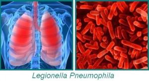 legionella-pneumophila1