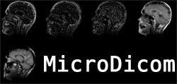 MicroDicom visualizzatore di immagini free e DICOM per Windows
