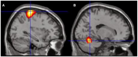 “ESPERIENZE FUORI DAL CORPO” (OBE): 3 STUDI SCIENTIFICI