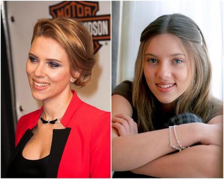 scarlett-johansson-chirurgia-estetica